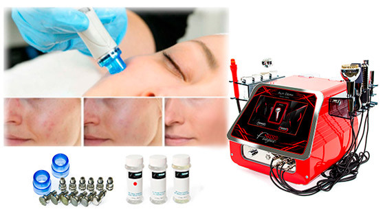 аппараты для гидродермабразии