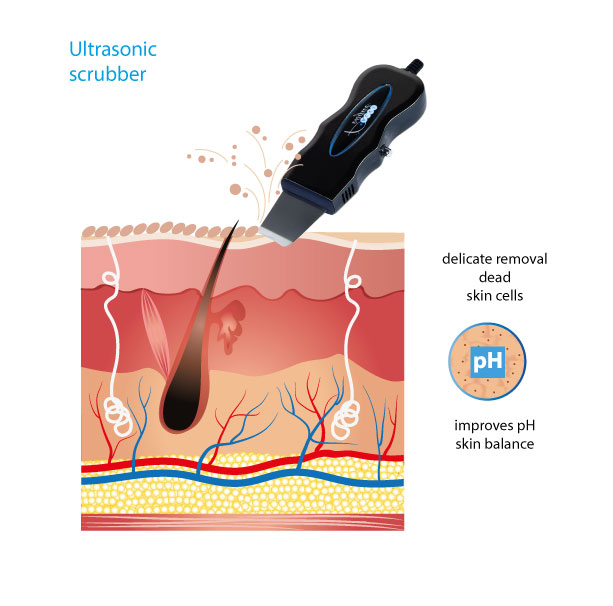 Ультразвуковой скрабер в аппарате S-02