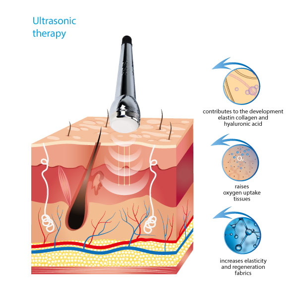 Дополнительные преимущества аппарата ультразвуковой терапии T-11